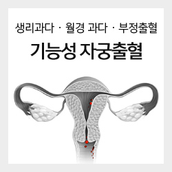 생리과다 · 월경 과다 · 부정출혈 기능성 자궁출혈