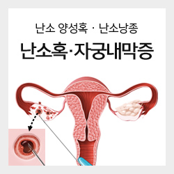 난소 양성혹 · 난소낭종 난소혹·자궁내막증