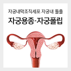 자궁내막조직세포 자궁내 돌출 자궁용종·자궁폴립