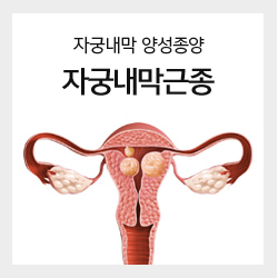 자궁내막 양성종양 자궁내막근종